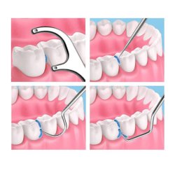 کیت تمیز کننده و جرم گیر دندان مدل استیل